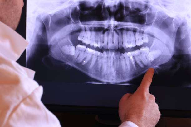 Best Emergency Dental Care for Broken or Chipped Teeth in Hackleburg, AL