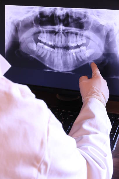 Best Emergency Tooth Extraction in Hackleburg, AL