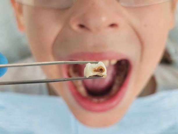 Best Emergency Gum Treatment in Hackleburg, AL